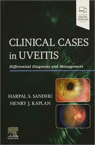 Clinical Cases in Uveitis: Differential Diagnosis and Management 1st Edition