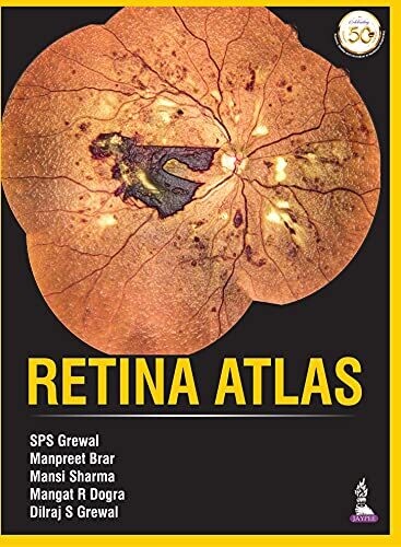Retina Atlas 1st Edition
