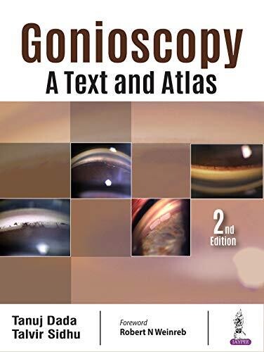 Gonioscopy: A Text and Atlas 2nd Edition