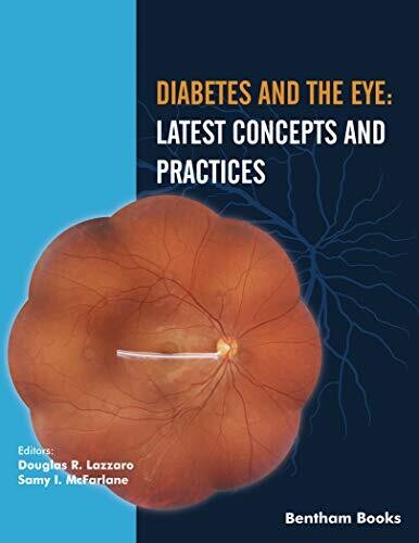 Diabetes and the Eye: Latest Concepts and Practices (Diabetes: Current and Future Developments Book 2)