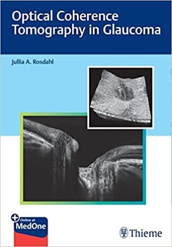 Optical Coherence Tomography in Glaucoma 1st Edition
