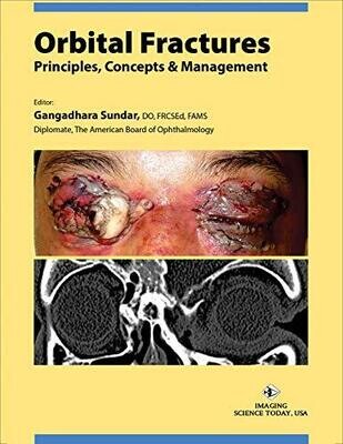 Orbital Fractures: Principles, Concepts &amp; Managements