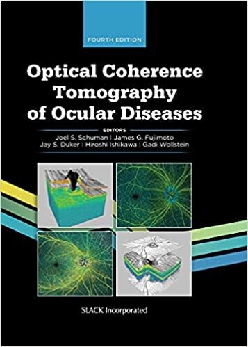 Optical Coherence Tomography of Ocular Diseases Fourth Edition