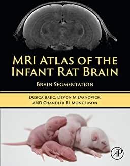 MRI Atlas of the Infant Rat Brain: Brain Segmentation