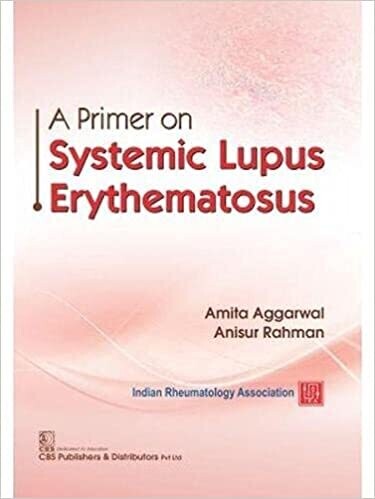 A Primer on Systemic Lupus Erythematosus