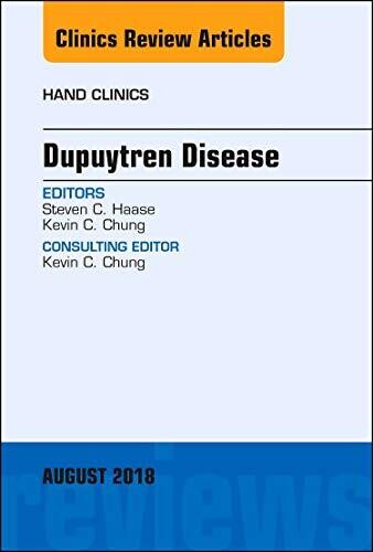 Dupuytren Disease, An Issue of Hand Clinics (Volume 34-4) (The Clinics: Orthopedics Volume 34-3)
