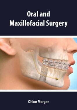 Oral and Maxillofacial Surgery