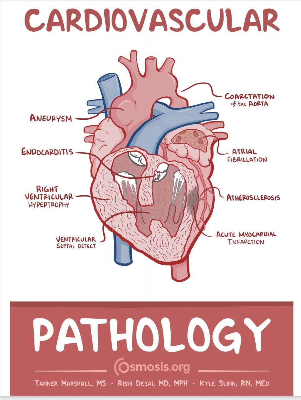 Cardiovascular Pathology Osmosis