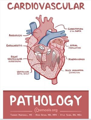 Cardiovascular Pathology Osmosis