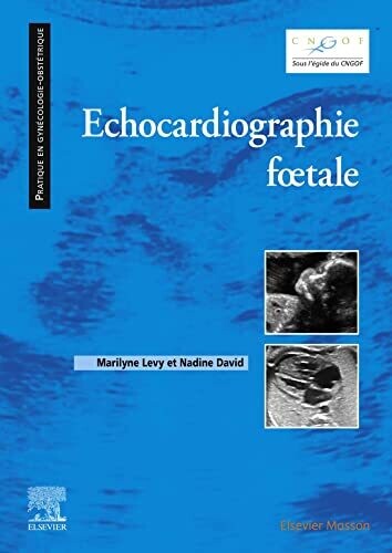 Echocardiographie fœtale (French Edition)