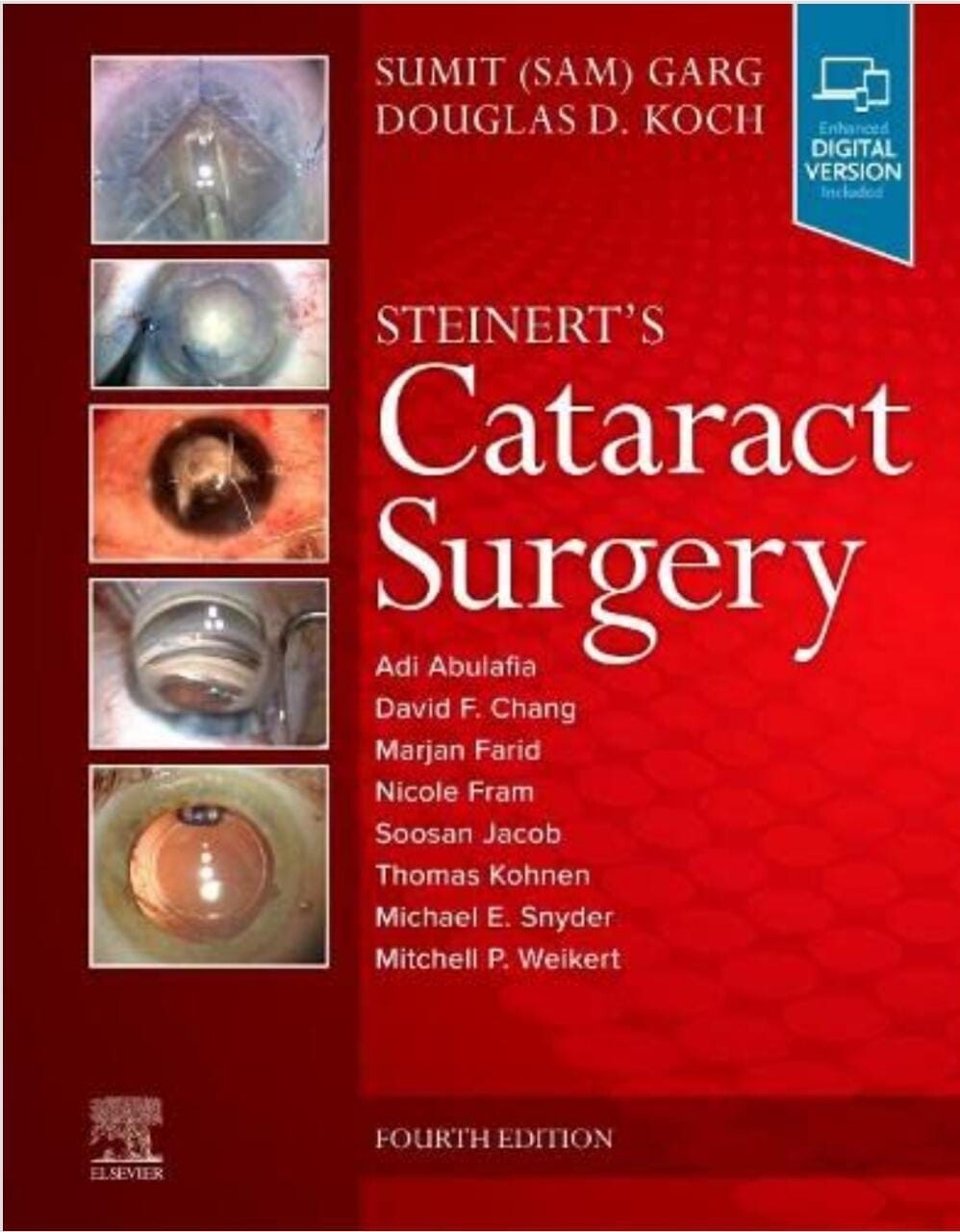 Steinert&#39;s Cataract Surgery 4th Edition 2022