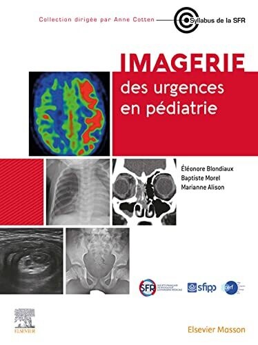 Imagerie des urgences en pédiatrie (French Edition)