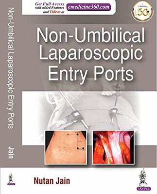 Non-Umbilical Laparoscopic Entry Ports 1st Edition
