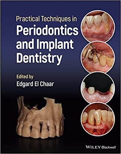 Practical Techniques in Periodontics and Implant Dentistry 1st Edition
