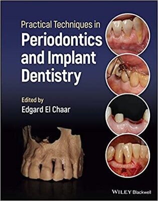 Practical Techniques in Periodontics and Implant Dentistry 1st Edition