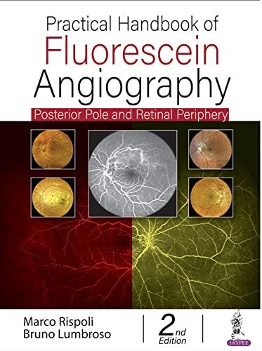 Practical Handbook of Fluorescein Angiography: Posterior Pole and Retinal Periphery 2nd Edition