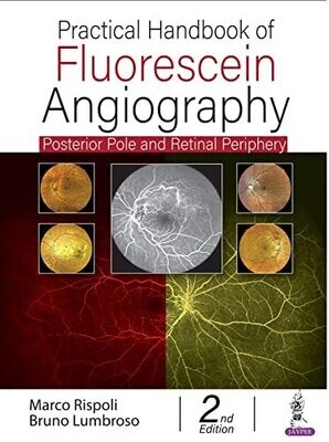 Practical Handbook of Fluorescein Angiography: Posterior Pole and Retinal Periphery 2nd Edition