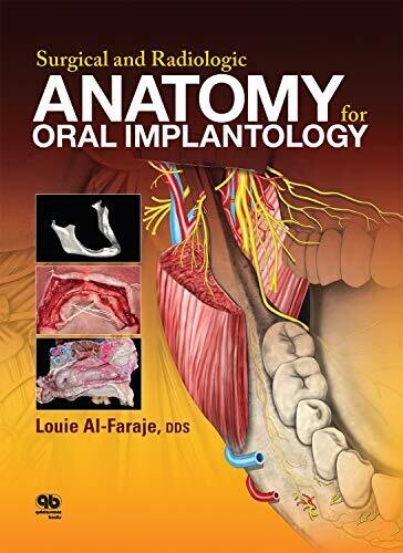 Surgical and Radiologic Anatomy of Oral Implantology 1st edition