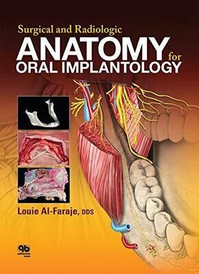 Surgical and Radiologic Anatomy of Oral Implantology 1st edition
