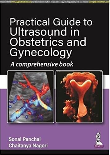PRACTICAL GUIDE TO ULTRASOUND IN OBSTETRICS AND GYNECOLOGY A COMPREHENSIVE BOOK