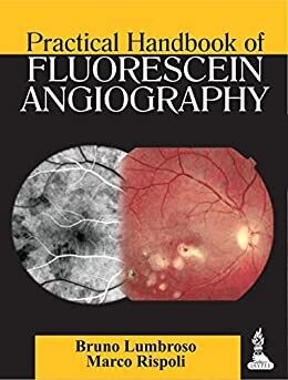Practical Handbook of Fluorescein Angiography