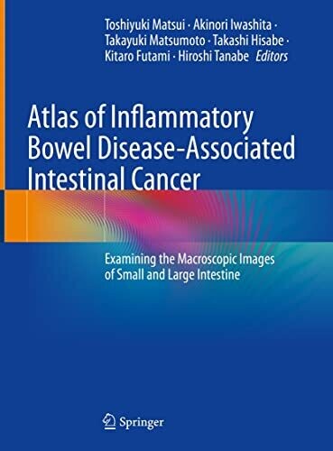 Atlas of Inflammatory Bowel Disease-Associated Intestinal Cancer: Examining the Macroscopic Images of Small and Large Intestine