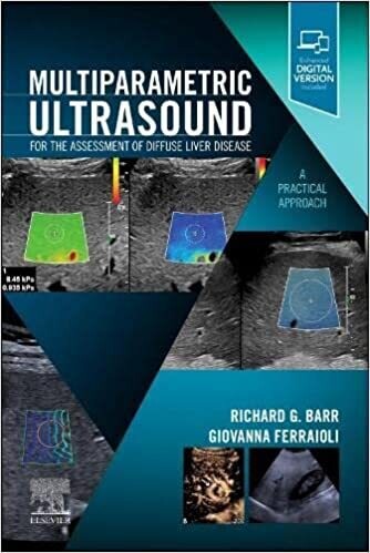 Multiparametric Ultrasound for the Assessment of Diffuse Liver Disease: A Practical Approach 1st Edition