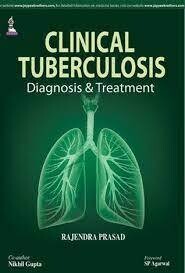 Clinical Tuberculosis: Diagnosis and Treatment