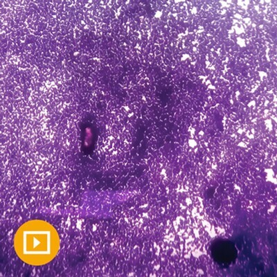Cytopathology 2022 (CME Videos)