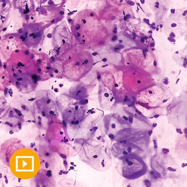 Gynecologic Pathology 2022 (CME Videos)