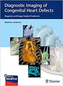 Diagnostic Imaging of Congenital Heart Defects: Diagnosis and Image-Guided Treatment 1st Edition (EPUB)