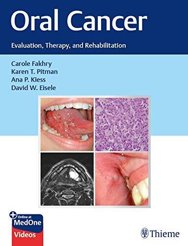 Oral Cancer: Evaluation, Therapy, and Rehabilitation 1st Edition (EPUB)