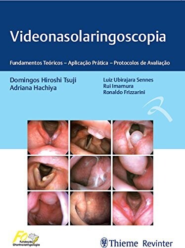 Videonasolaringoscopia: Fundamentos teóricos – aplicação prática – protocolos de avaliação