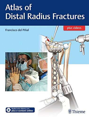 Atlas of Distal Radius Fractures 1st Edition