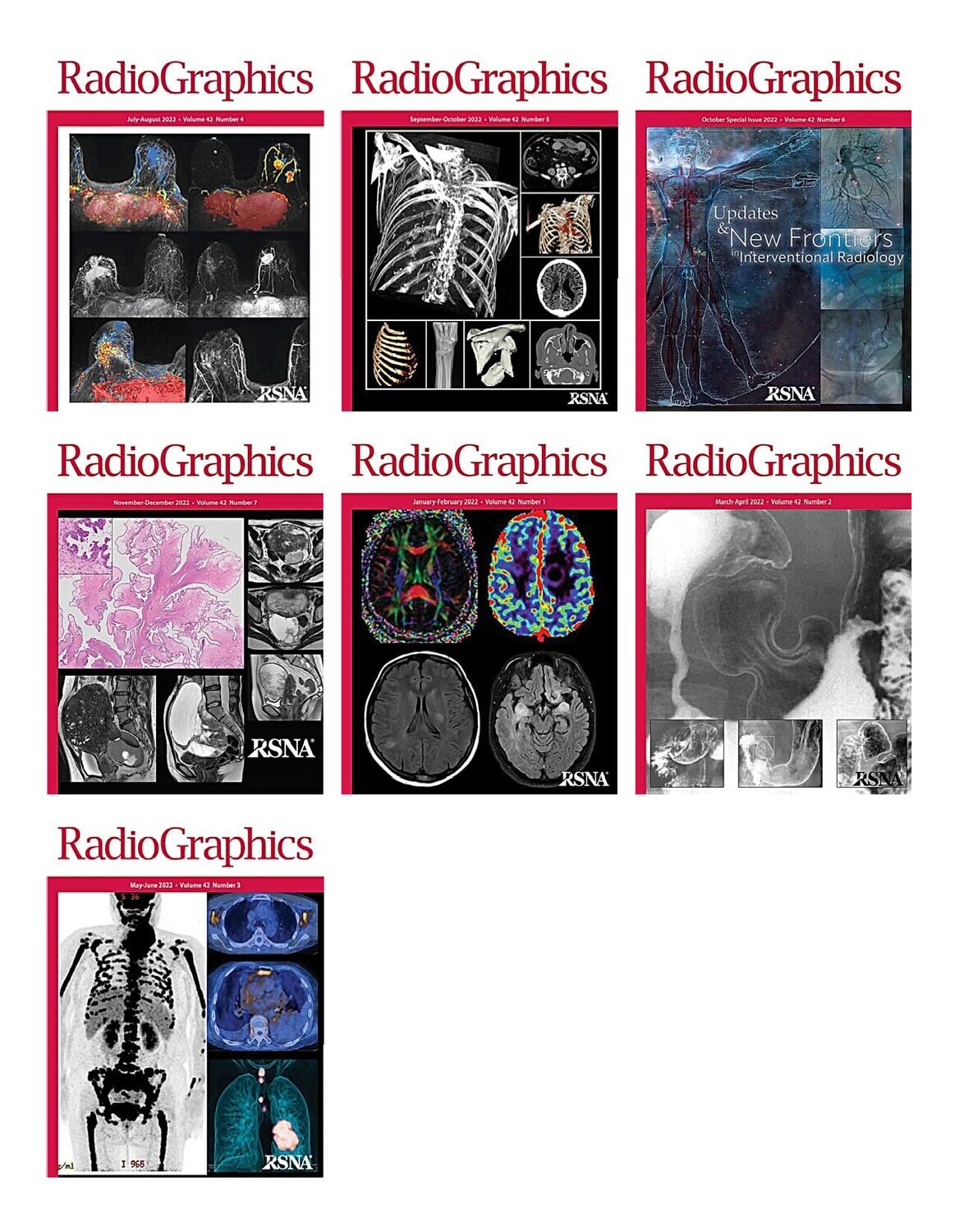 RadioGraphics 2022 Full Archives
