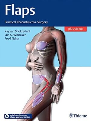 Flaps: Practical Reconstructive Surgery 1st Edition