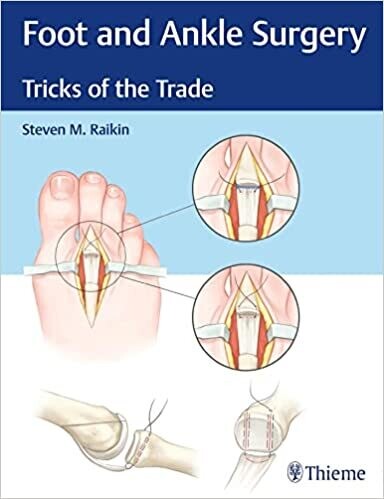 Foot and Ankle Surgery: Tricks of the Trade