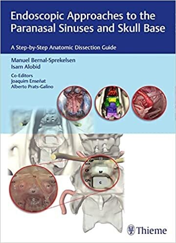 Endoscopic Approaches to the Paranasal Sinuses and Skull Base: A Step-by-Step Anatomic Dissection Guide 1st Edition