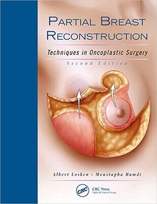 Partial Breast Reconstruction: Techniques in Oncoplastic Surgery 2nd Edition