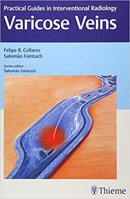 Varicose Veins: Practical Guides in Interventional Radiology 1st Edition