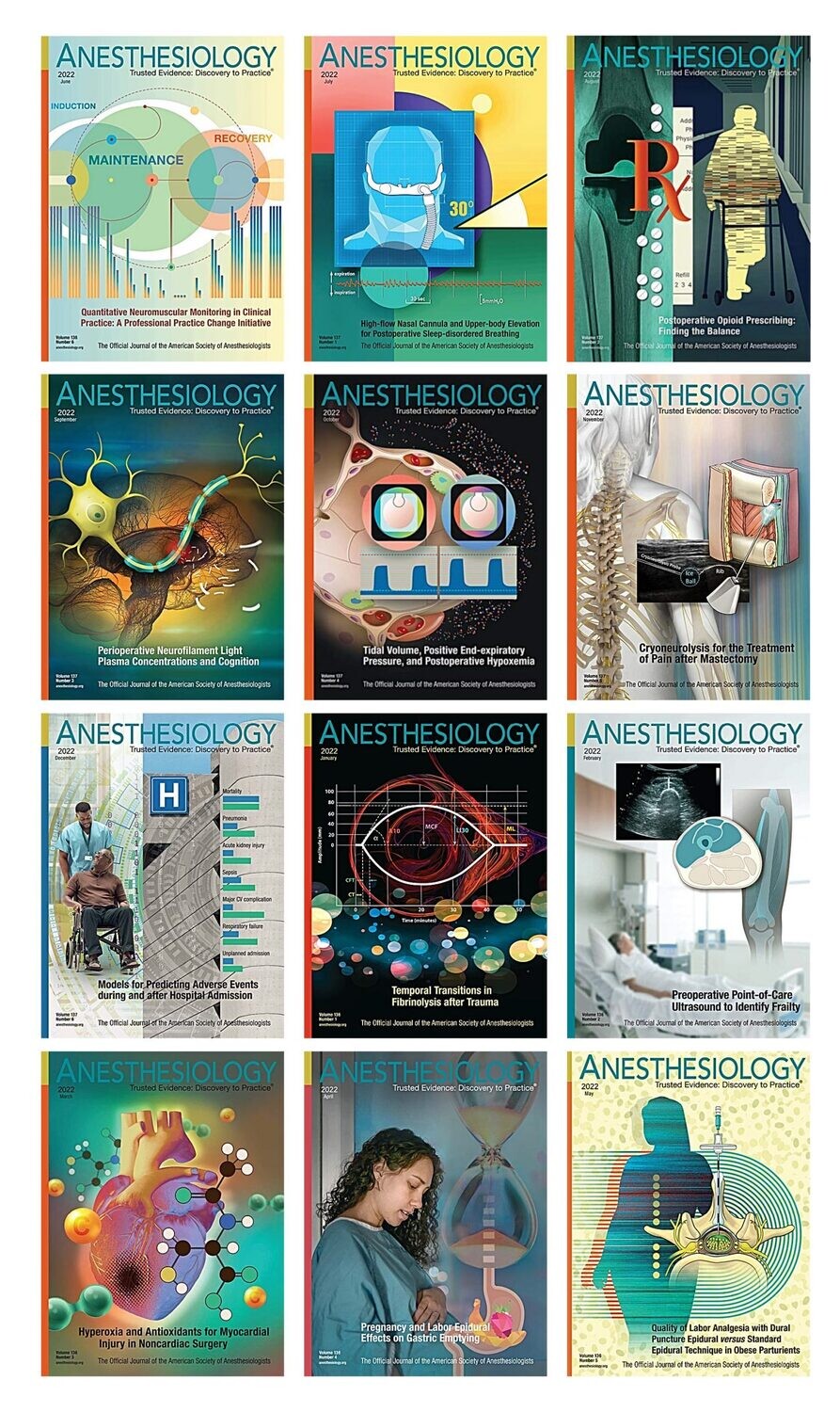 Anesthesiology Full Archives of Journal 2022