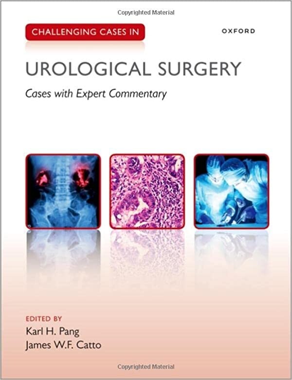 Challenging Cases in Urological Surgery 2022