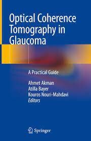 Optical Coherence Tomography in Glaucoma
A Practical Guide