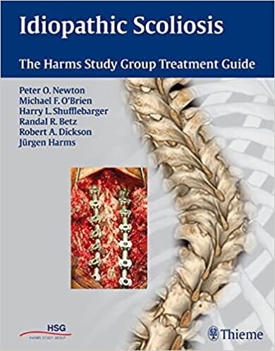 Idiopathic Scoliosis: The Harms Study Group Treatment Guide 1st Edition