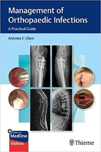 Management of Orthopaedic Infections: A Practical Guide 1st Edition