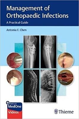 Management of Orthopaedic Infections: A Practical Guide 1st Edition
