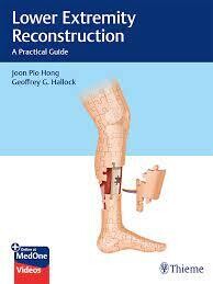 Lower Extremity Reconstruction: A Practical Guide 1st Edition