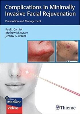 Complications in Minimally Invasive Facial Rejuvenation: Prevention and Management 1st Edition