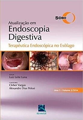 Atualização em Endoscopia Digestiva - Volume 2