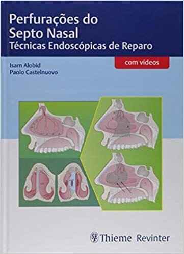 Perfurações do Septo Nasal: Técnicas Endoscópicas de Reparo